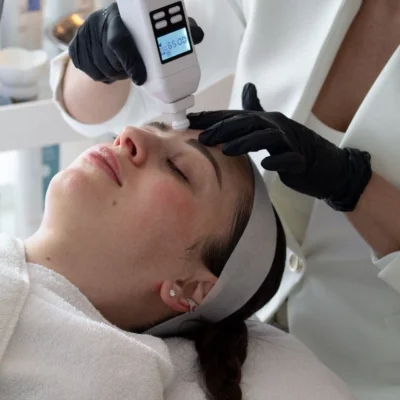 Microneedling Skin Kosmetikstudio Göttingen (5)